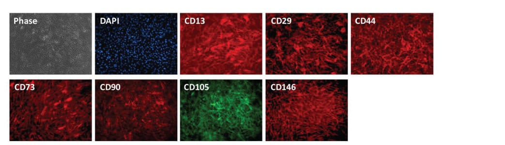 Mesenchymal Stem Cells